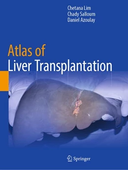 Abbildung von Lim / Salloum | Atlas of Liver Transplantation | 1. Auflage | 2026 | beck-shop.de