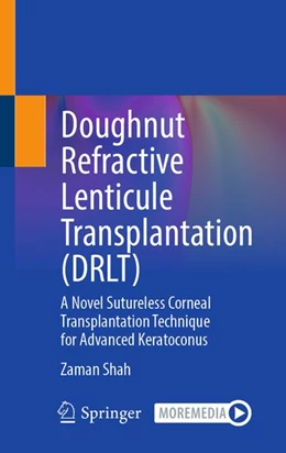 Abbildung von Shah | Doughnut Refractive Lenticule Transplantation (DRLT) | 1. Auflage | 2026 | beck-shop.de