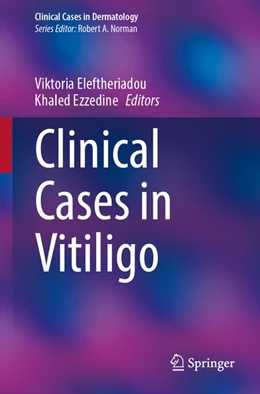 Abbildung von Eleftheriadou / Ezzedine | Clinical Cases in Vitiligo | 1. Auflage | 2026 | beck-shop.de