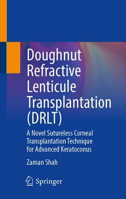 Abbildung von Shah | Doughnut Refractive Lenticule Transplantation (DRLT) | 1. Auflage | 2026 | beck-shop.de