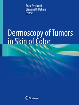Abbildung von Errichetti / Behera | Dermoscopy of Tumors in Skin of Color | 1. Auflage | 2027 | beck-shop.de