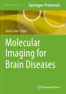Abbildung von Sone | Molecular Imaging for Brain Diseases | 1. Auflage | 2026 | beck-shop.de