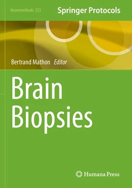 Abbildung von Mathon | Brain Biopsies | 1. Auflage | 2026 | beck-shop.de