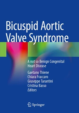 Abbildung von Thiene / Fraccaro | Bicuspid Aortic Valve Syndrome | 1. Auflage | 2026 | beck-shop.de