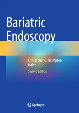 Abbildung von Thompson | Bariatric Endoscopy | 2. Auflage | 2026 | beck-shop.de