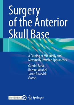 Abbildung von Zada / Wrobel | Surgery of the Anterior Skull Base | 1. Auflage | 2026 | beck-shop.de