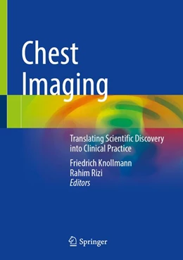 Abbildung von Knollmann / Rizi | Chest Imaging | 1. Auflage | 2026 | beck-shop.de