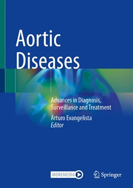 Abbildung von Evangelista | Aortic Diseases | 1. Auflage | 2026 | beck-shop.de