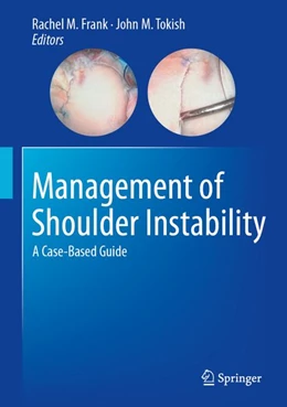 Abbildung von Frank / Tokish | Management of Shoulder Instability | 1. Auflage | 2026 | beck-shop.de