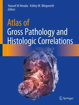Abbildung von Al Hmada / Illingworth | Atlas of Gross Pathology and Histologic Correlations | 1. Auflage | 2026 | beck-shop.de