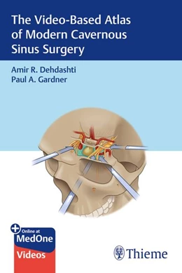 Abbildung von The Video-Based Atlas of Modern Cavernous Sinus Surgery | 1. Auflage | 2026 | beck-shop.de