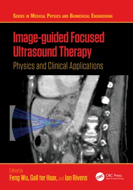 Abbildung von Wu / Haar | Image-guided Focused Ultrasound Therapy | 1. Auflage | 2026 | beck-shop.de