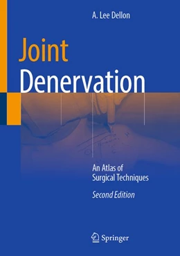 Abbildung von Dellon | Joint Denervation | 2. Auflage | 2026 | beck-shop.de