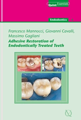Abbildung von Mannocci / Gagliani | Adhesive Restoration of Endodontically Treated Teeth | 1. Auflage | 2010 | beck-shop.de