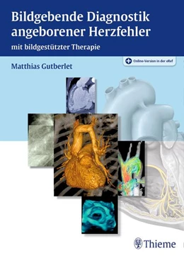 Abbildung von Gutberlet | Bildgebende Diagnostik angeborener Herzfehler | 1. Auflage | 2021 | beck-shop.de